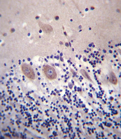 Polyclonal Rabbit anti-Human CACNA2D2 Antibody (aa643-671, IHC, IF, WB)