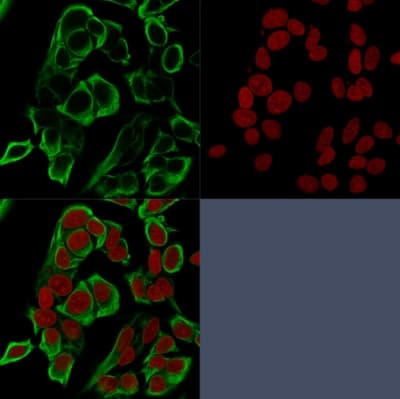 Recombinant Monoclonal Mouse anti-Human EPCAM Antibody (clone rMOC-31, IHC)