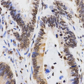 Histone H3 Antibody (Di-Methyl-Lys9)