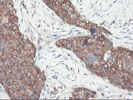 PFKP Antibody (clone OTI2E8, Carrier-free)