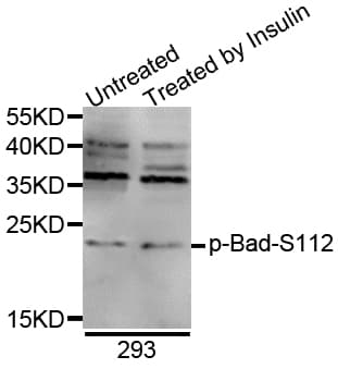 BAD Antibody (phospho-Ser75)