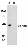 IHC-plus™ Polyclonal Rabbit anti-Human CXCR6 Antibody (IHC, IF, WB)