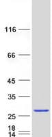 Human ARL6 Protein (Recombinant Myc-DDK (Flag))