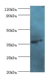 AGA / Aspartylglucosaminidase Antibody (aa206-346)
