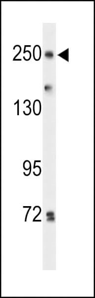 IHC-plus™ PTPRD / RPTP-Delta Antibody (aa343-371)