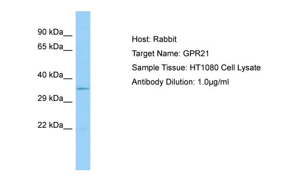 GPR21 Antibody (aa197-246)