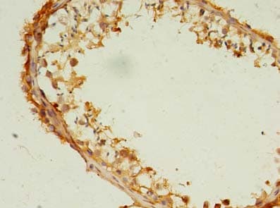 Polyclonal Rabbit anti-Human CCT6B Antibody (IHC)