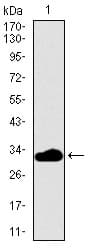 Monoclonal Mouse anti-Human FcERI / Fc Epsilon RI Antibody (clone 1F2A9, aa42-103, WB)