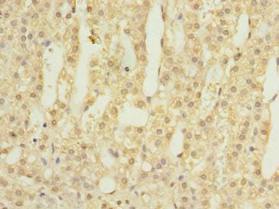 LOH12CR1 Antibody
