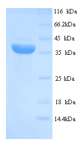 Human MAGEA1 / MAGE 1 Protein (Recombinant 6His, N-terminus)
