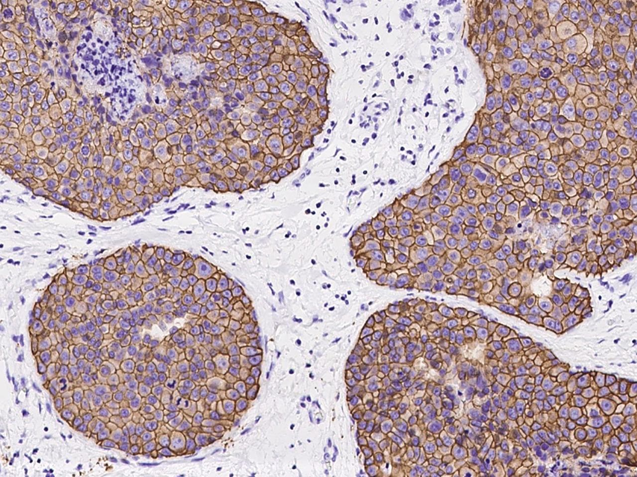 Polyclonal Rabbit anti-Human ERBB2 / HER2 Antibody (IHC)