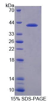 Human N-CoR / NCOR1 Protein (Recombinant His, N-Terminal)