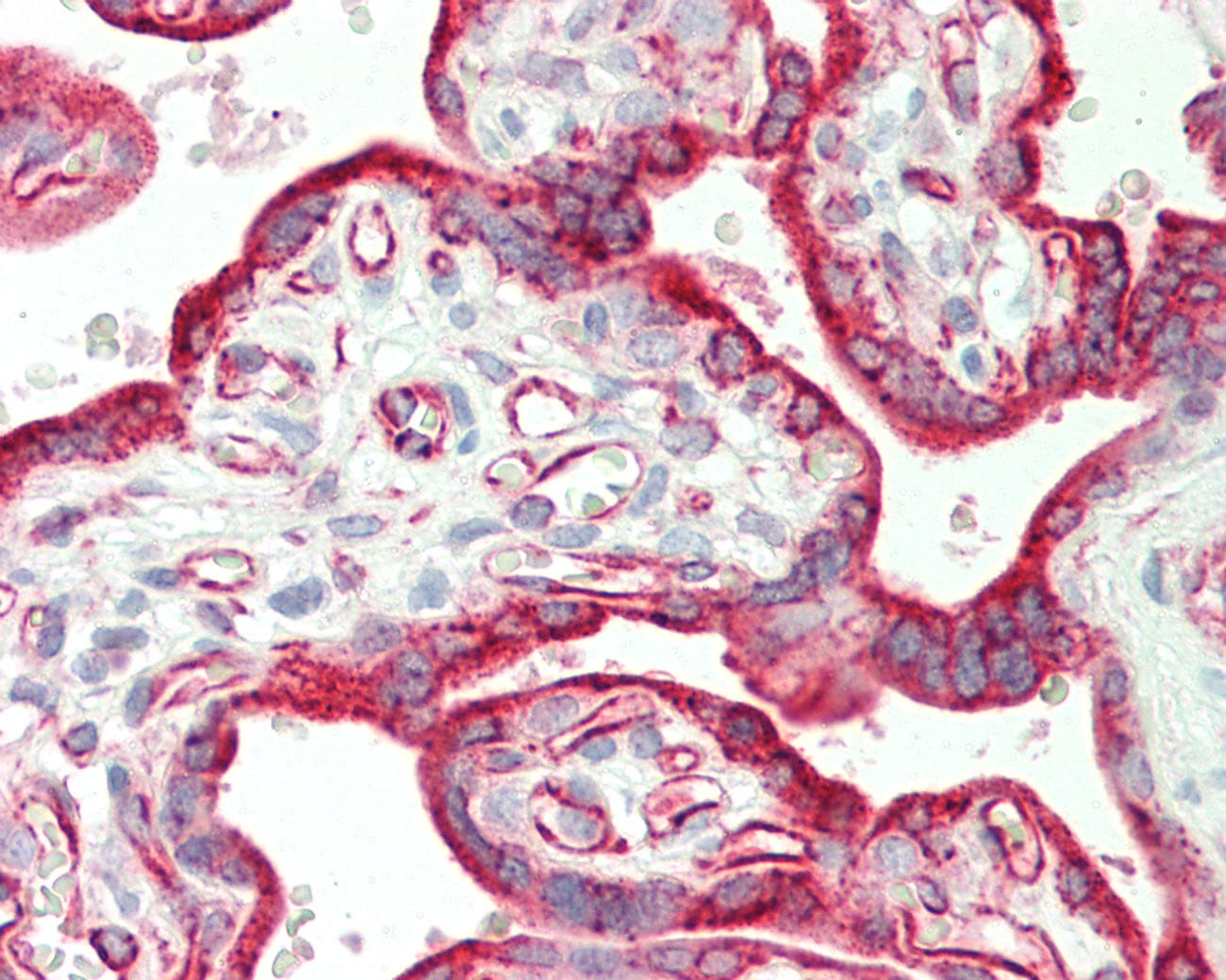Polyclonal Rabbit anti-Human CSH2 / Placental Lactogen Antibody (aa35-84, IHC, WB)