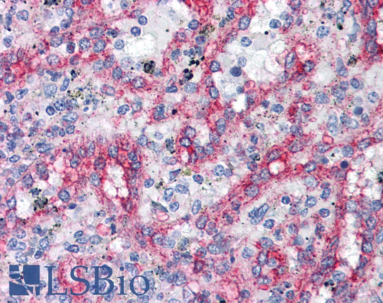IHC-plus™ ITGB1 / Integrin Beta 1 / CD29 Antibody (clone 4B7R, FITC)