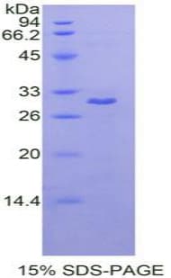 Rat MAPK8 / JNK1 Protein (Recombinant His-T7)