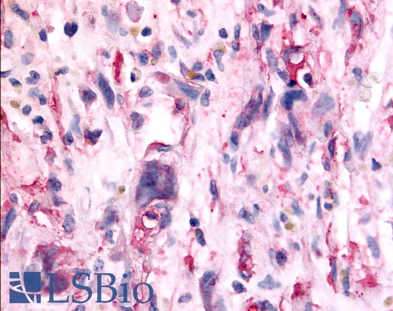 PathPlus™ TAOK1 / TAO1 Antibody (Internal)