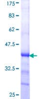 Human ADAMTS15 Protein (Recombinant GST, N-terminus)