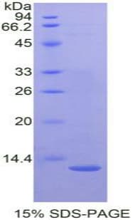 Mouse CTNNBIP1 / ICAT Protein (Recombinant His-T7)