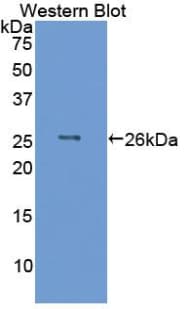IL6 / Interleukin 6 Antibody (aa29-212)