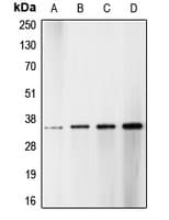CDC2 + CDK2 + CDK3 Antibody (phospho-Thr14)
