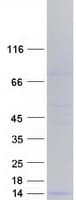 Human DEFB113 Protein (Recombinant Myc-DDK (Flag))
