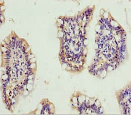 GNA15 Antibody