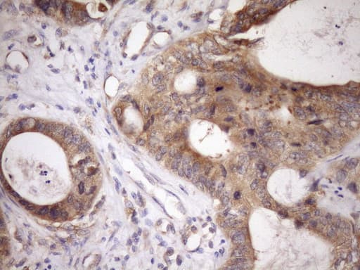 TARBP2 / TRBP2 Antibody (clone OTI7C1, Carrier-free)