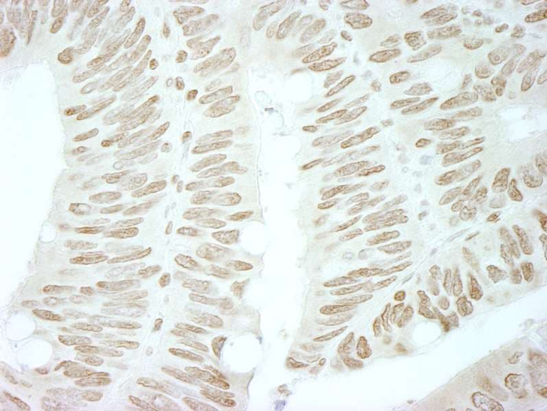 Polyclonal Rabbit anti-Human BRD4 Antibody (aa1312-1362, IHC)