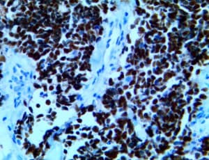 INSM1 Antibody (Ready-to-Use)