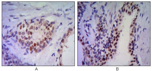 NKX3-1 Antibody (clone 4H4)