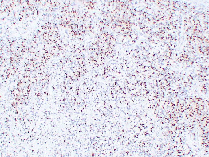 MYOG / Myogenin Antibody (clone ABT-MYOG)