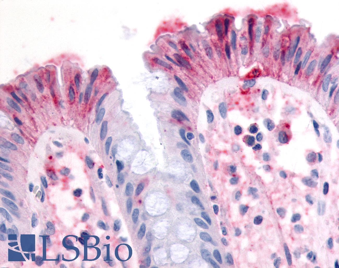IHC-plus™ Polyclonal Rabbit anti-Human MST1R / RON Antibody (N-Terminus, IHC)