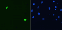 DUX4 Antibody (clone P2B1)