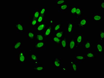 GRG4 / TLE4 Antibody
