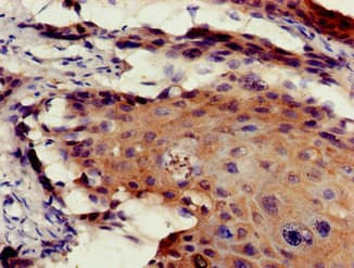 Polyclonal Rabbit anti-Human TEL-2 / ETV7 Antibody (aa134-218, IHC, WB)