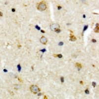 Polyclonal Rabbit anti-Human CEP135 Antibody (C-Terminus, IHC, WB)