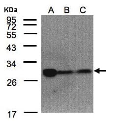 IHC-plus™ CLPP Antibody (aa215-277)