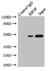 Polyclonal Rabbit anti-Human EIF3S5 / EIF3F Antibody (IHC)