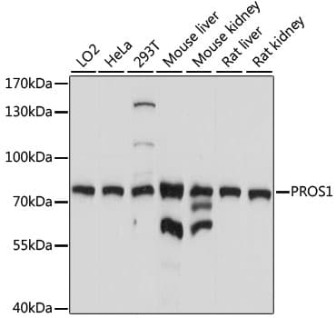 IHC-plus™ PROS1 / Protein S Antibody