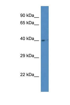 Polyclonal Rabbit anti-Human AGA / Aspartylglucosaminidase Antibody (aa138-187, WB)