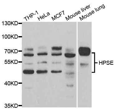 HPSE / Heparanase Antibody (aa36-275)