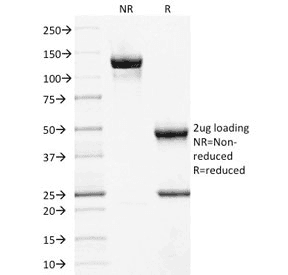 MME / CD10 Antibody (clone MME/1892)