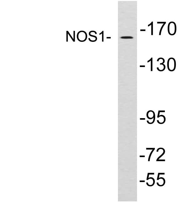 Polyclonal Rabbit anti-Human NOS1 / nNOS Antibody (aa293-342, WB)