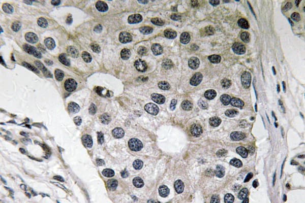Polyclonal Rabbit anti-Human Leptin Antibody (aa36-85, IHC)