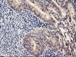 PDSS2 / DLP1 Antibody (clone OTI1D12)