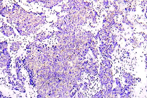 PRKAA1 / AMPK Alpha 1 Antibody (Arg493)