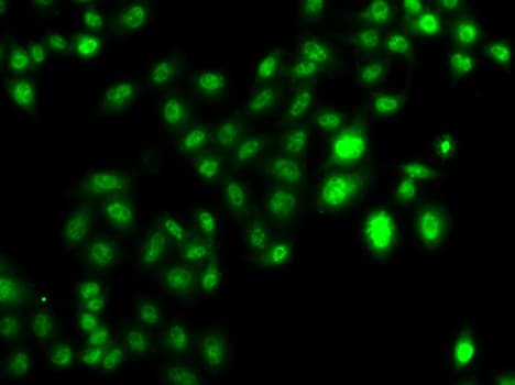 IHC-plus™ CBFA2T2 / MTGR1 Antibody