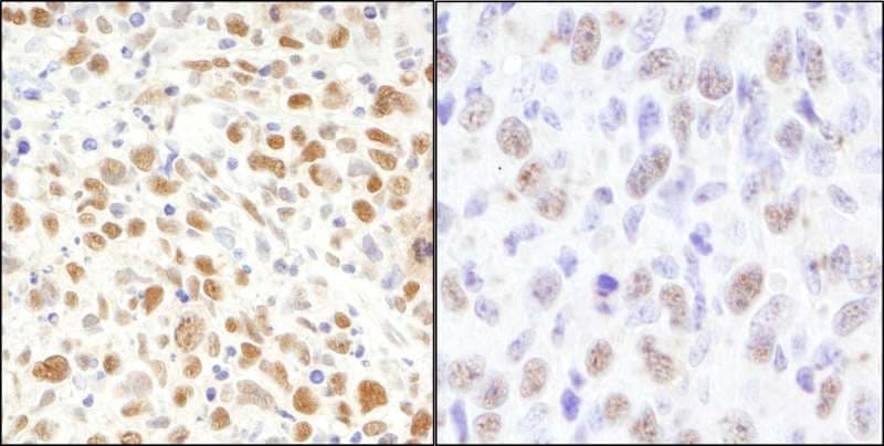 MSH2 Antibody (aa875-C-term)