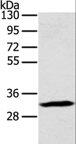 Polyclonal Rabbit anti-Human STX11 / Syntaxin 11 Antibody (IHC, WB)