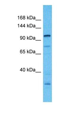 Polyclonal Rabbit anti-Human MAP4 Antibody (N-Terminus, IHC, WB)
